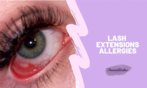 eyelash-extension-allergy